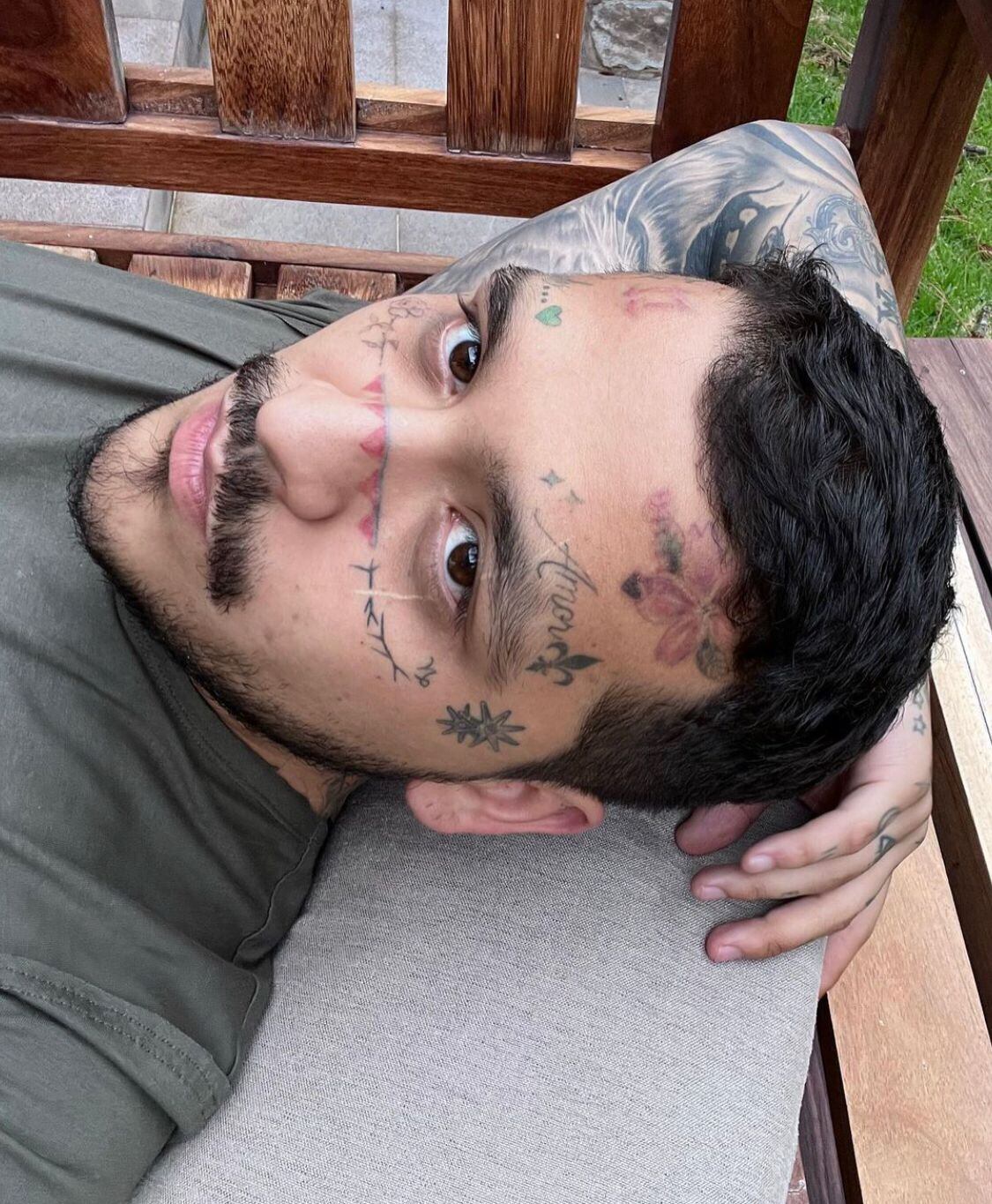 Así avanza el procedimiento con el que Nodal se borra los tatuajes