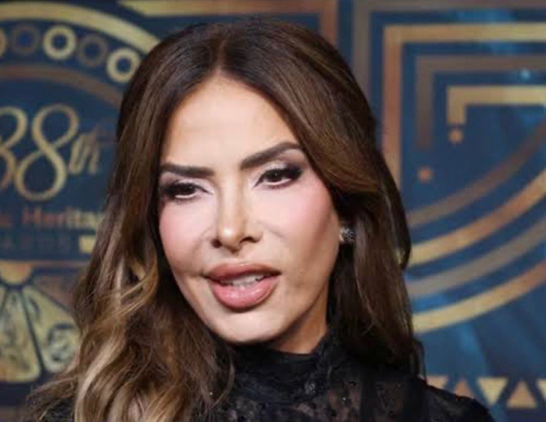 Gloria Trevi rompe el silencio sobre su parálisis facial