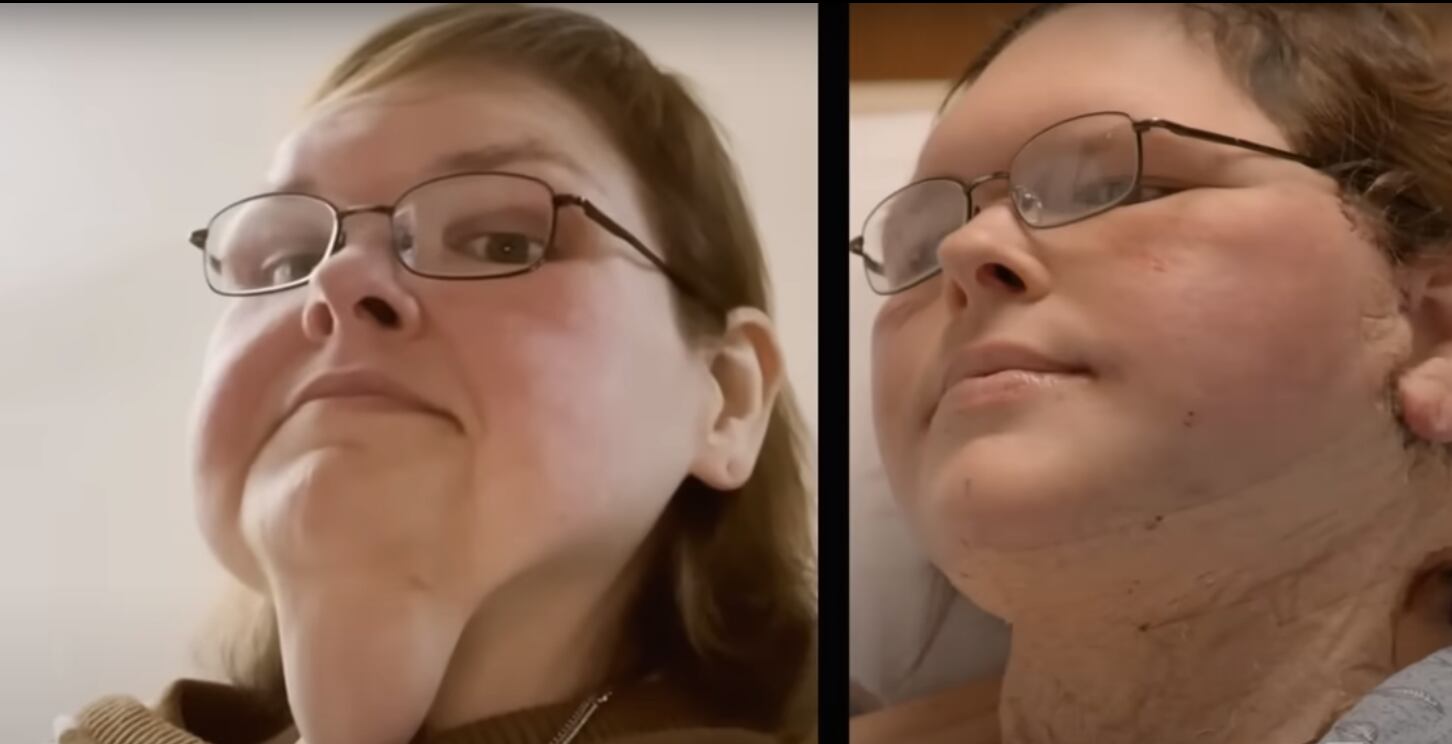 Tammy Slaton reaparece tras perder más de 220 kilos y someterse a cirugía reconstructiva