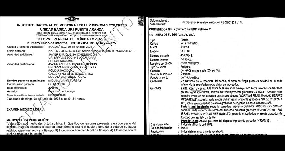 El informe de Medicina Legal revela que Miguel Uribe Turbay recibió dos impactos de bala por parte del sicario.