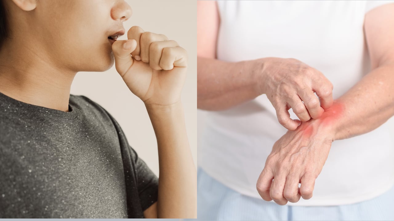Las autoridades de salud promueven la detección temprana de tuberculosis y lepra, así como la consulta oportuna ante cualquier señal de alerta.