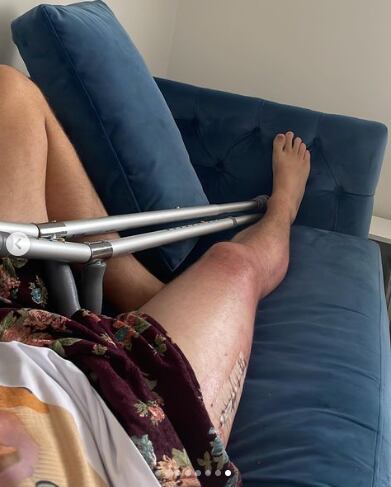 Kevin Parker tendrá dos semanas de recuperación antes de su show en el Estéreo Picnic.