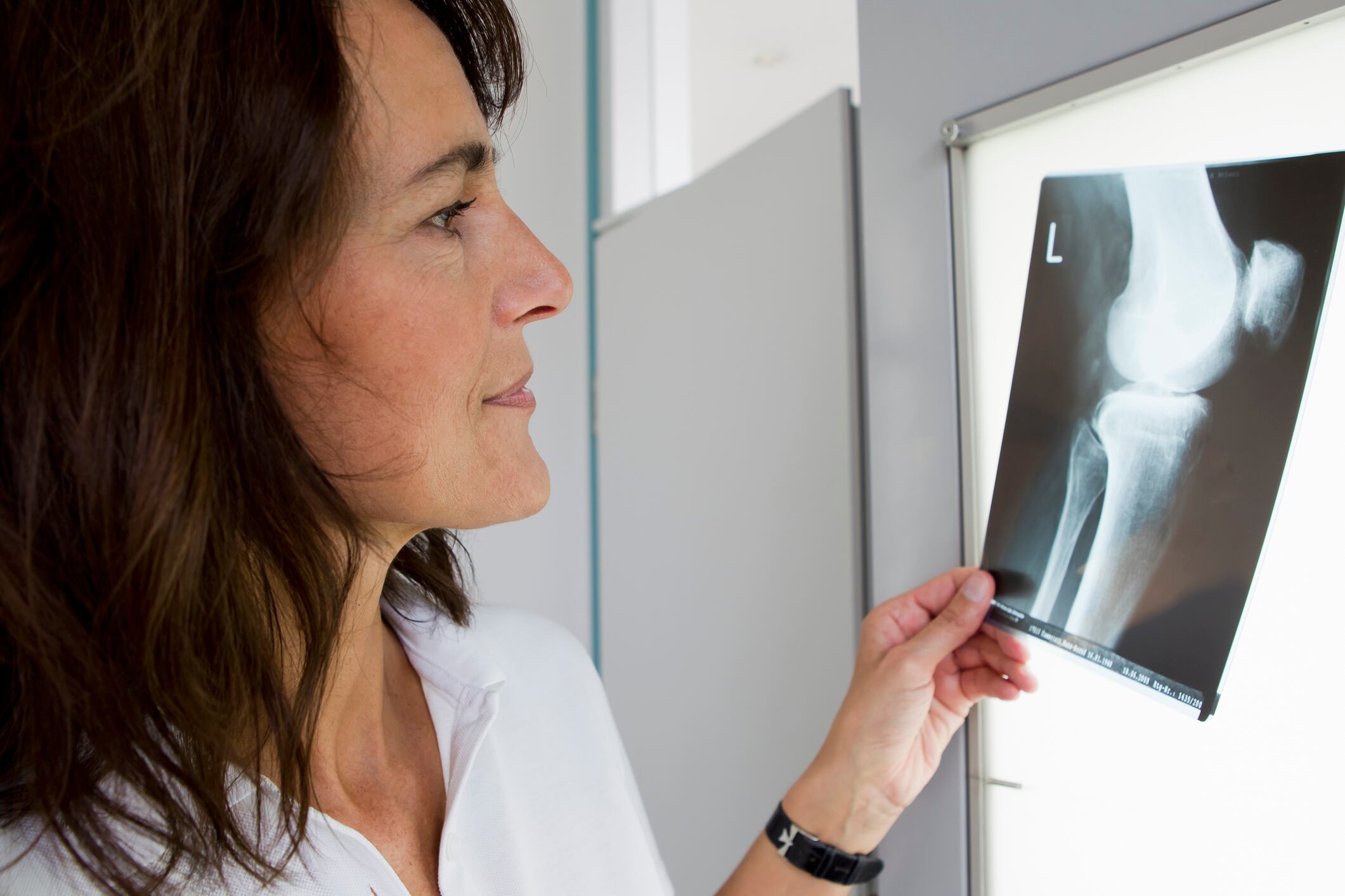 Experta afirma que misiones como Artemis II producen pérdidas de masa ósea en los astronautas de hasta "un 1,5% por mes".