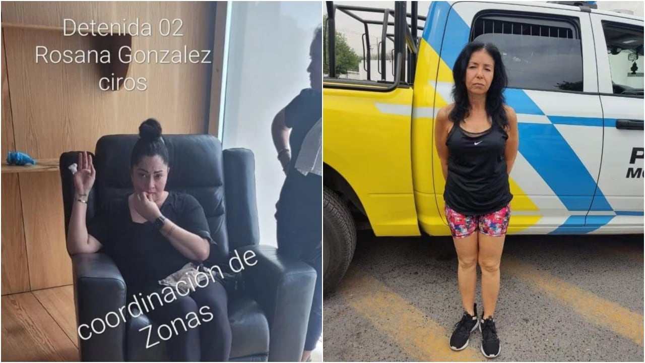 Revelan las escalofriantes fotos de la mujer a la que le arrancaron un dedo tras pelea por una máquina en reconocido gimnasio