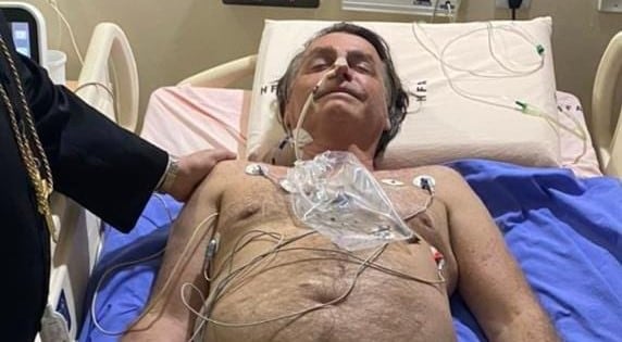 Jair Boslonaro está hospitalizado por un hipo persistente causado por una obstrucción intestinal
