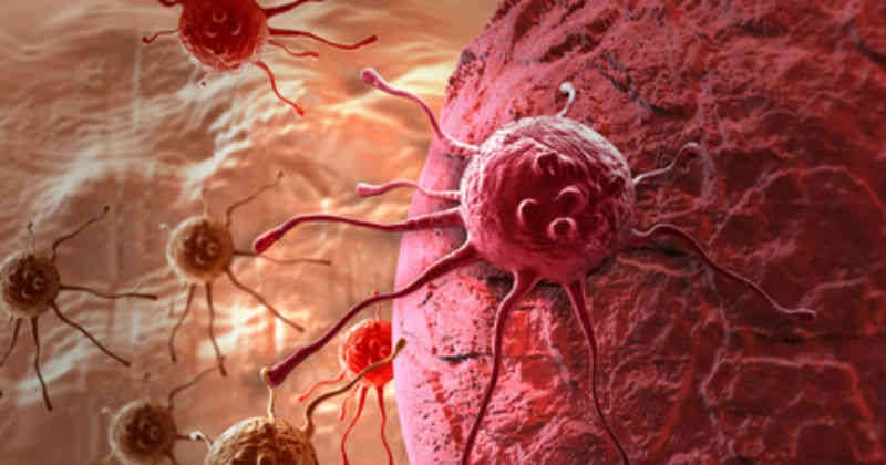 El Mieloma Múltiple (MM), es el tipo de cáncer que afecta a las células plasmáticas, que son las que se encargan de combatir las infecciones
