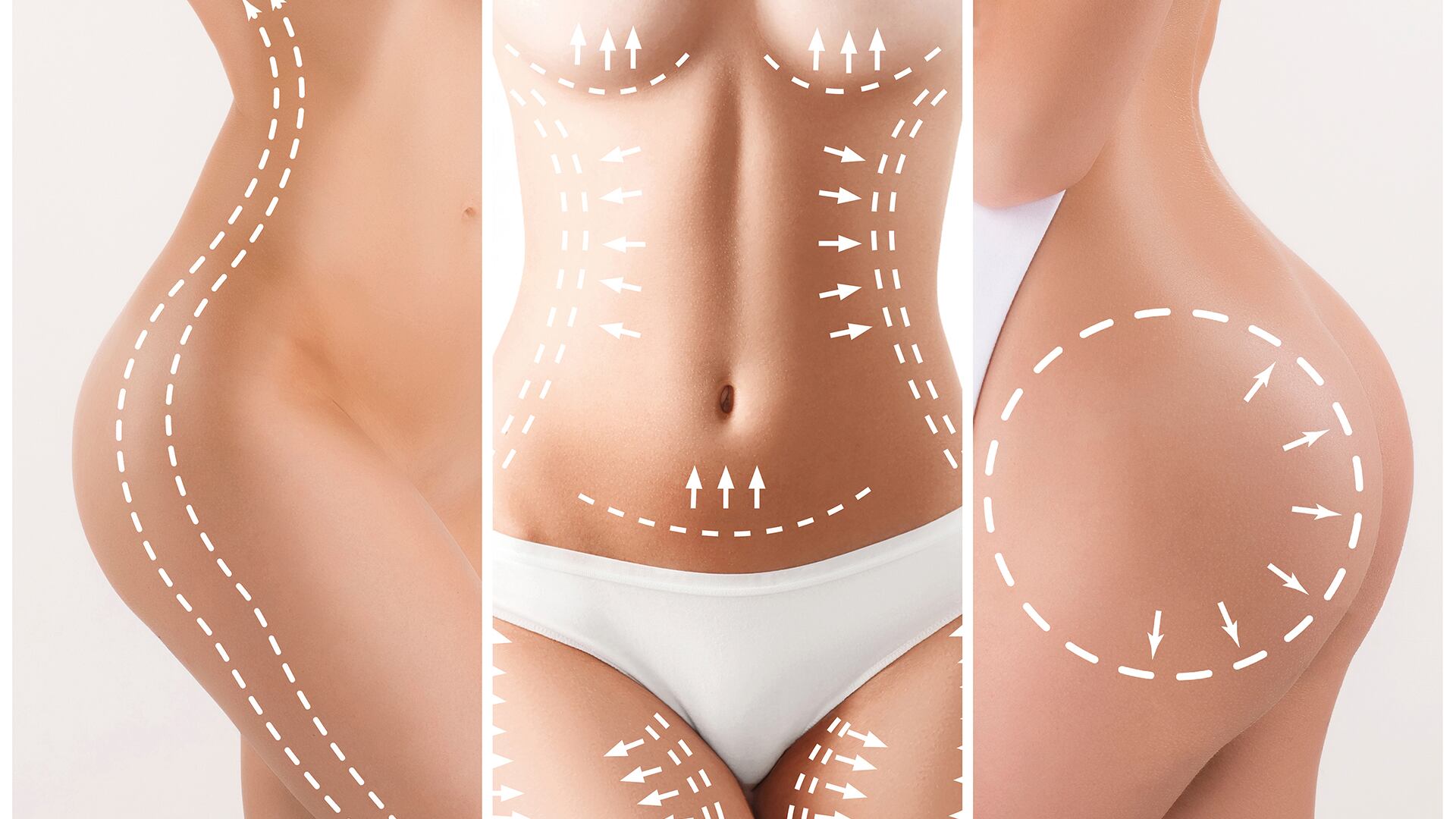 Las cirugías plásticas de hoy en día persiguen la naturalidad, asegura el cirujano plástico y reconstructivo Rafael Pérez Franco,