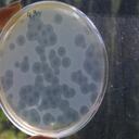 Los investigadores analizaron 124 adultos y descubrieron que la mayoría de los sistemas digestivos tienen mucho en común: al menos 57 especies de bacterias estaban en casi todos los humanos. En total, los científicos catalogaron cerca de 1.000 especies diferentes y suponen que hay unas 150 más que no encontraron.