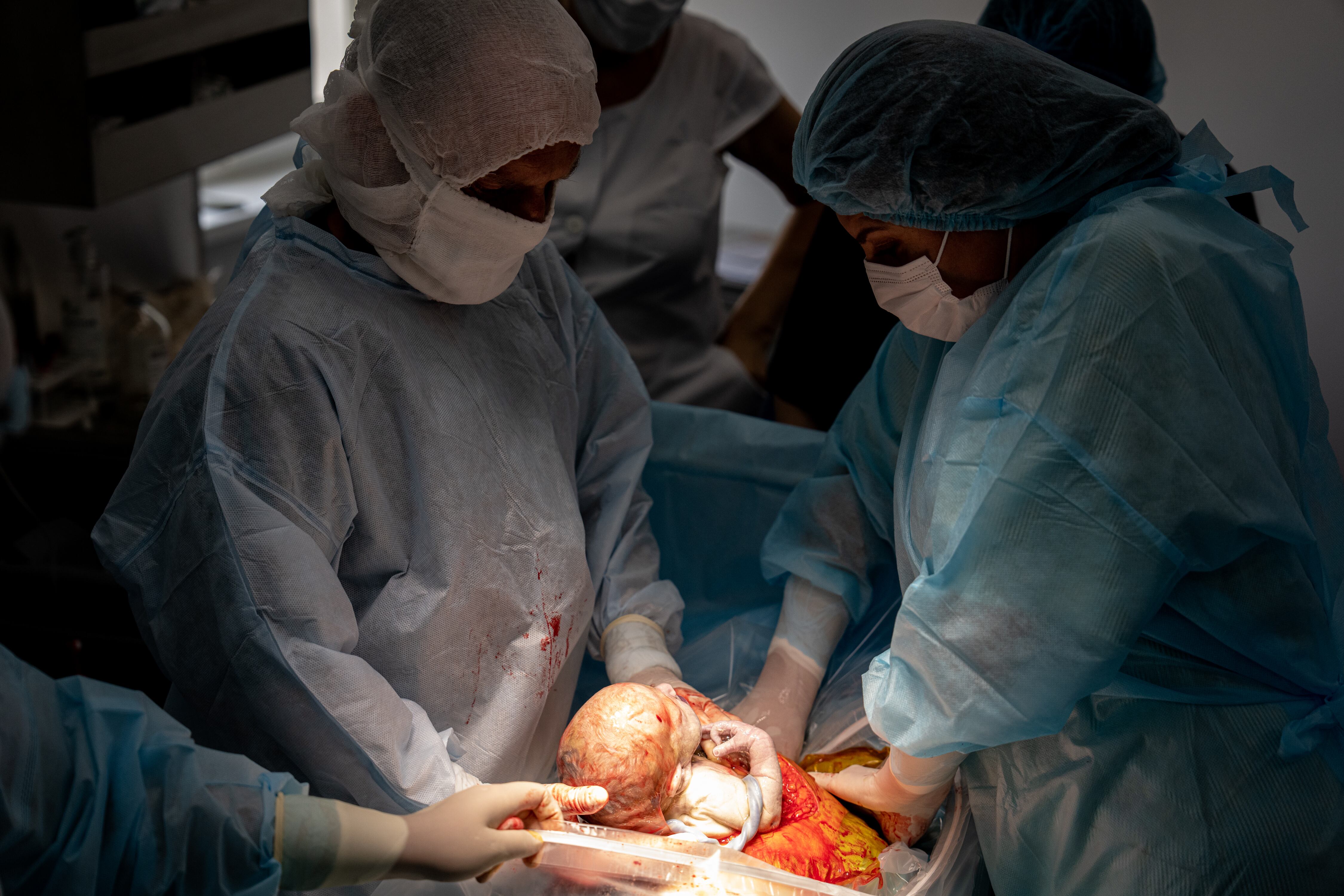 El hombre alega que presenciar la cesárea le ocasionó problemas en su matrimonio