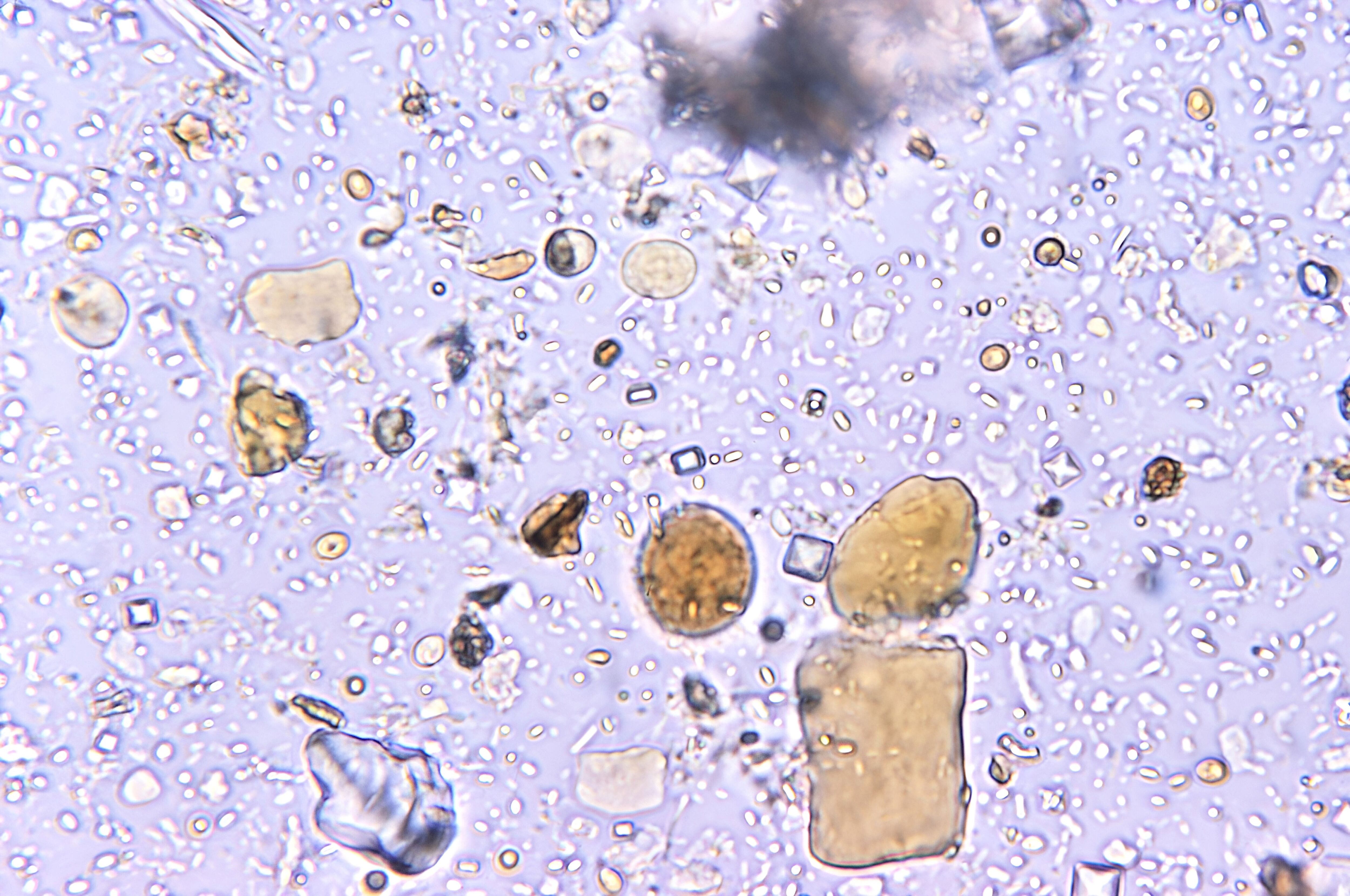 Con un aumento de 500X, esta microfotografía de una muestra concentrada y teñida con yodo en montaje directo reveló la presencia de un parásito protozoario Entamoeba coli. CDC/Dr. Moore 1972. (Foto de: CDC/IMAGE POINT FR/BSIP/Universal Images Group vía Getty Images)