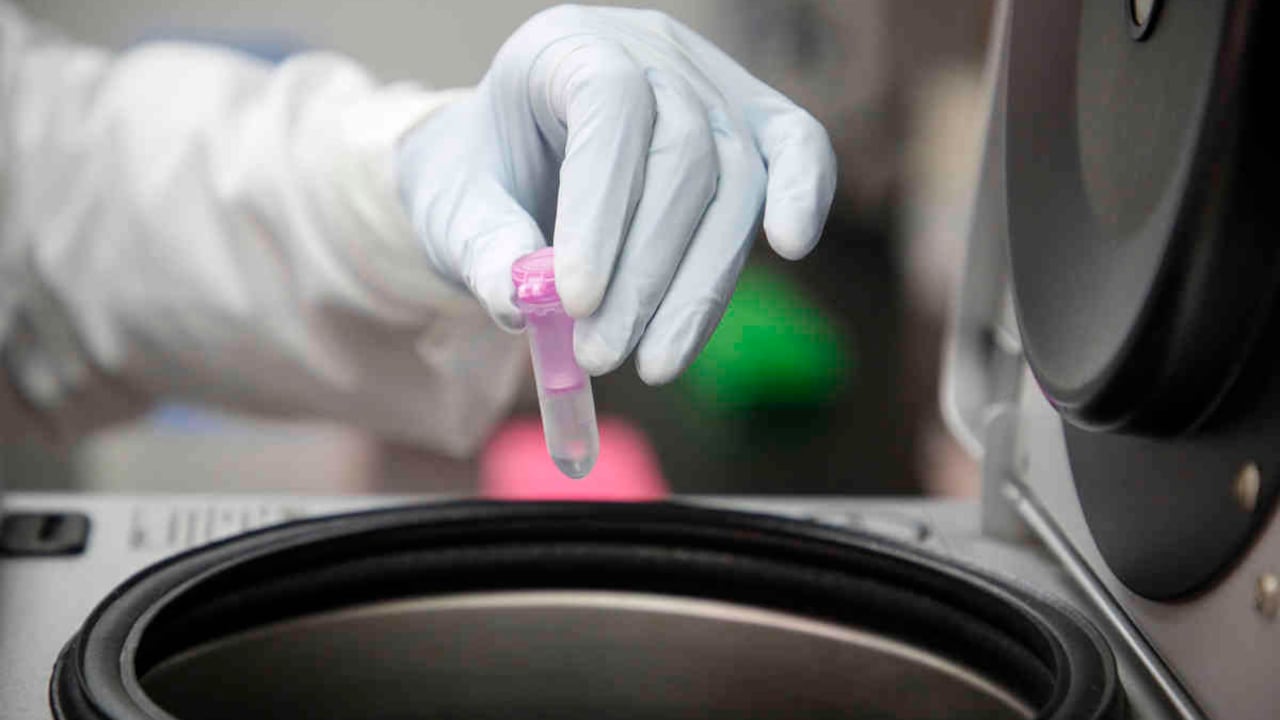 Coronavirus: estudian posible rol protector de la nicotina frente al virus/Foto: Guillermo Torres Reina/SEMANA