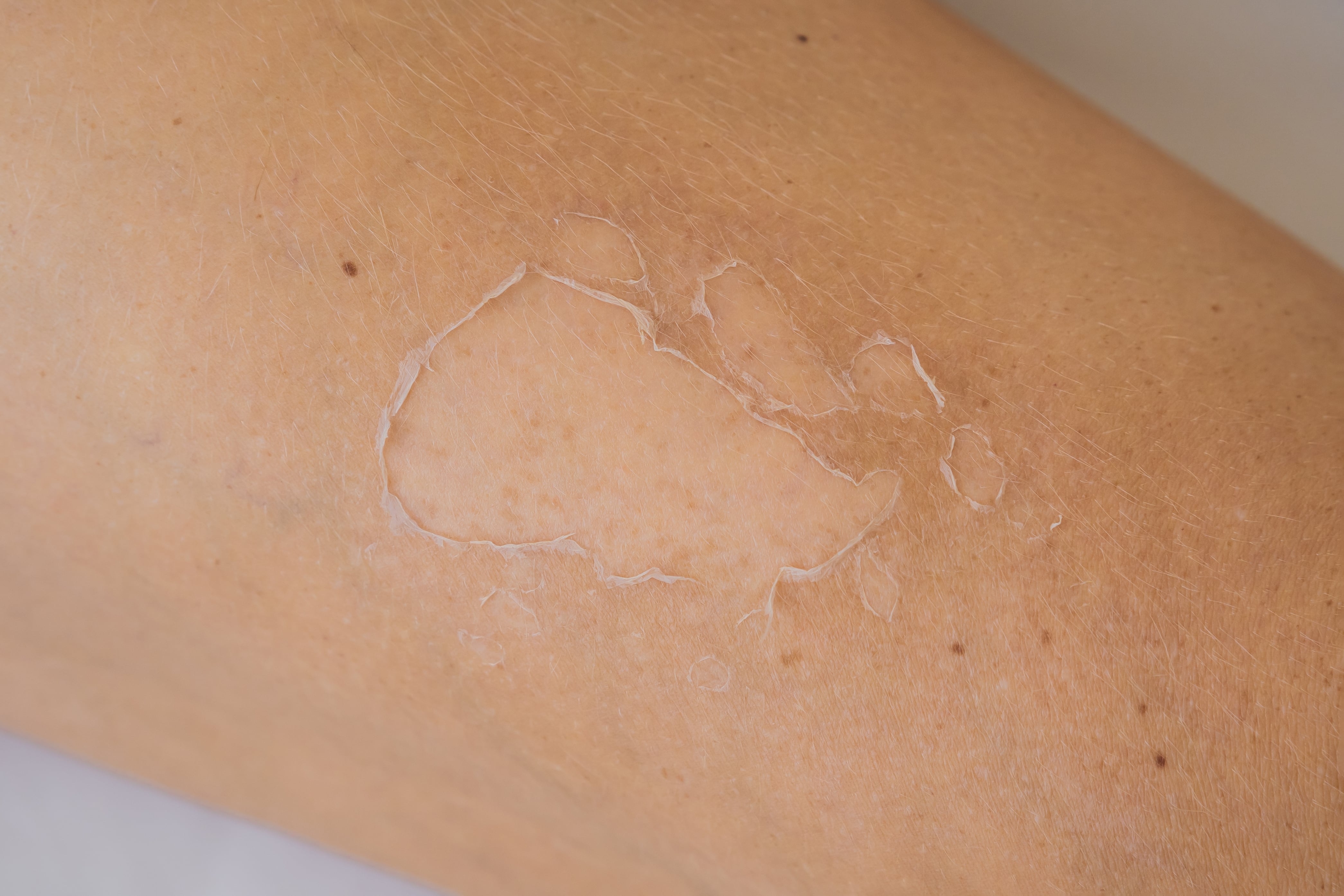 De esta forma puede mejorar el aspecto de la piel.