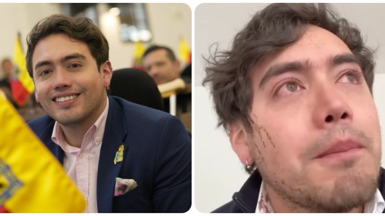 El concejal de Bogotá, Julián Triana, herido en un atraco.