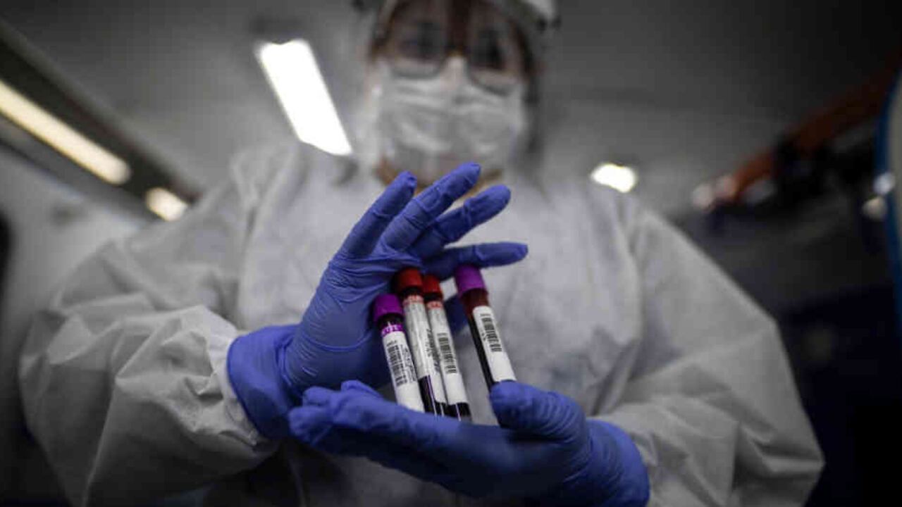 La donación de sangre bajó durante la pandemia de covid-19.