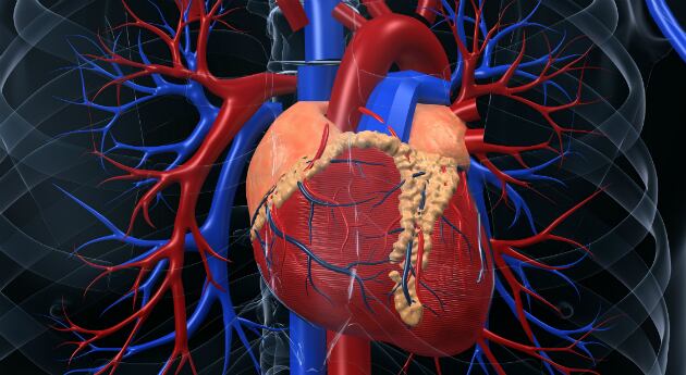 Una ruptura en la aorta puede ser la raíz del problema. 