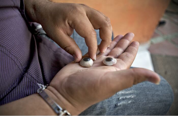 JORGE: Jorge Mario Carbonell tiene 19 años y está próximo a graduarse de bachiller. A la edad de 7 años, mientras jugaba en el antejardín de su casa en Santa Marta, recibió el impacto de una bala perdida, producto del atentado que acabó con la vida de un joven habitante del sector, al parecer, en un ajuste de cuentas entre grupos paramilitares. El disparo entró por la ceja y se alojó en su ojo derecho, y la bala sólo pudo ser retirada diez días después. En ese momento cursaba segundo de primaria. Desde entonces ha tenido cuatro prótesis oculares que su madre conserva sin un motivo especial. Jorge Mario quiere estudiar en el SENA y especializarse en el manejo de maquinaria pesada. Le gusta reunirse a charlar con sus amigos, la televisión y la rumba.