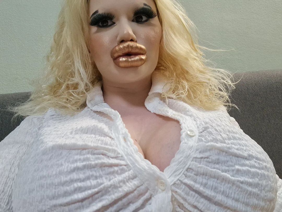 El aumento de labios le ha traído grandes beneficios a su vida, pero al mismo tiempo la han llevado a fracasar en el amor.