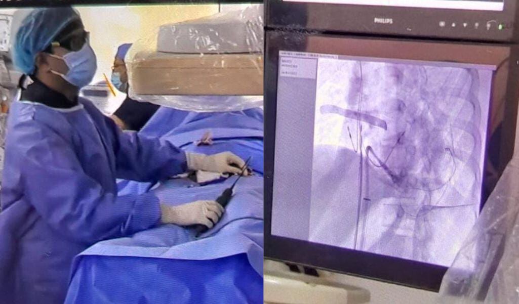 Tras entrenarse en EE.UU., implantó el primer Micra en la clínica y en Carolina, su primera paciente.