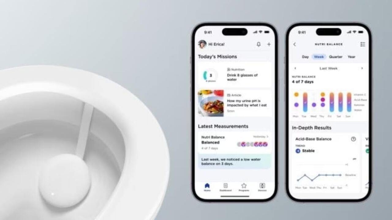 U-Scan ayuda a analizar la orina y determinar alguna alteración.