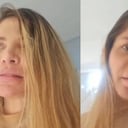 Reacciones en redes por su complejo caso.