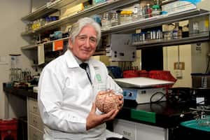 Francisco Lopera
Neurólogo
Doctor
Investigador
Facultad Nacional de Salud Publica
Universidad de Antioquia
UDA
Investigador
Medicina
Medellín
Colombia
Revista Semana
Fotos: Pablo Andrés Monsalve Mesa