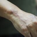 La mujer se sumergió a un canal de aguas para apagar las llamas.