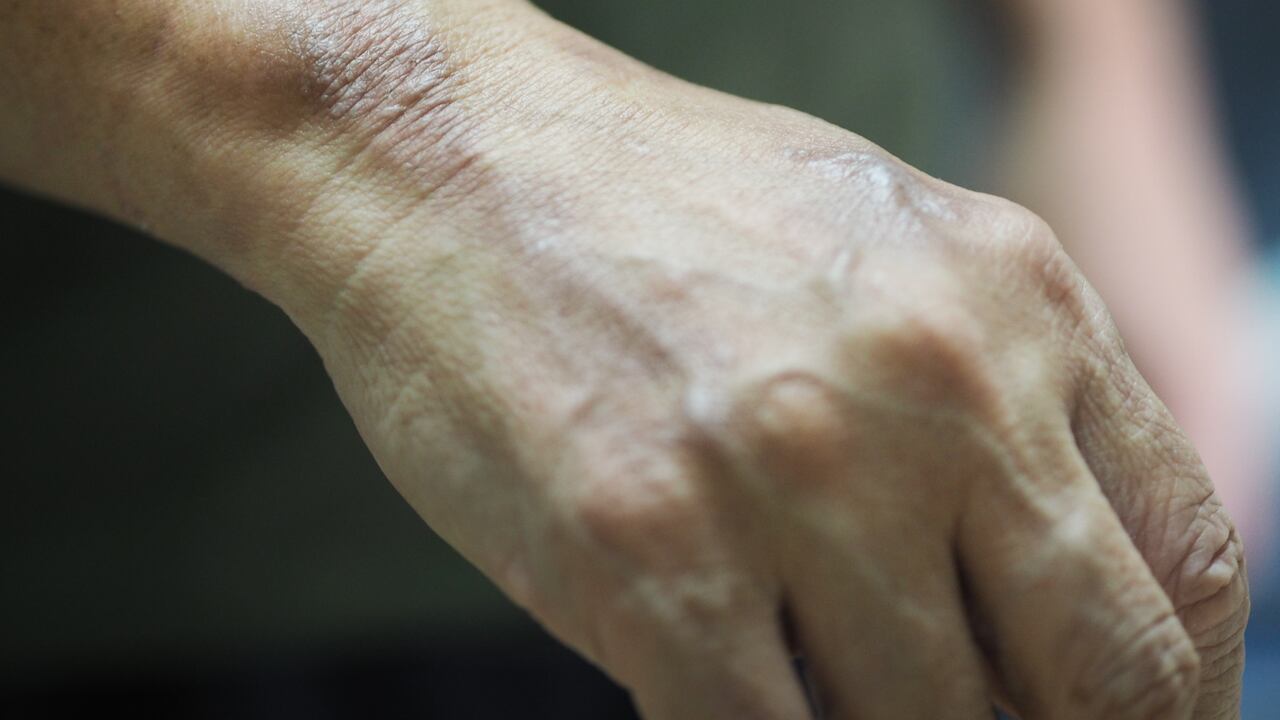 La mujer se sumergió a un canal de aguas para apagar las llamas.