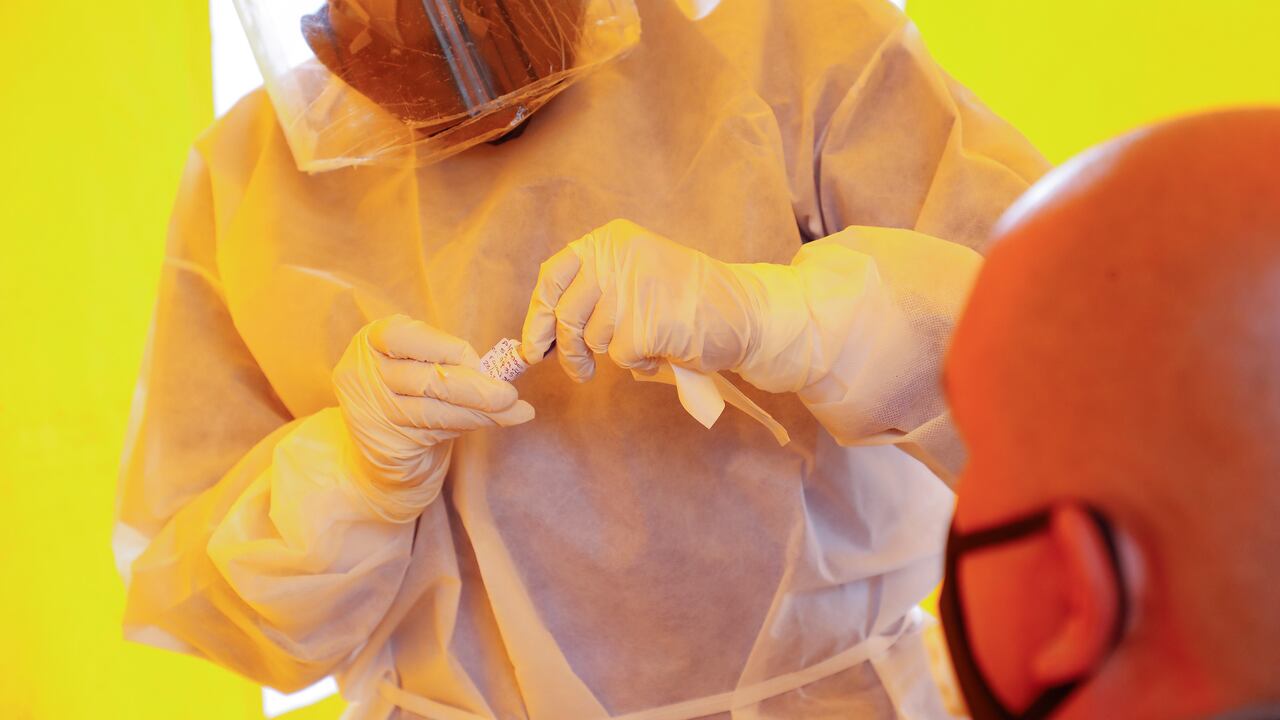 Caída de pelo y coronavirus: ¿qué tiene que ver?