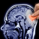 La pérdida de la memoria es un "olvido inusual".