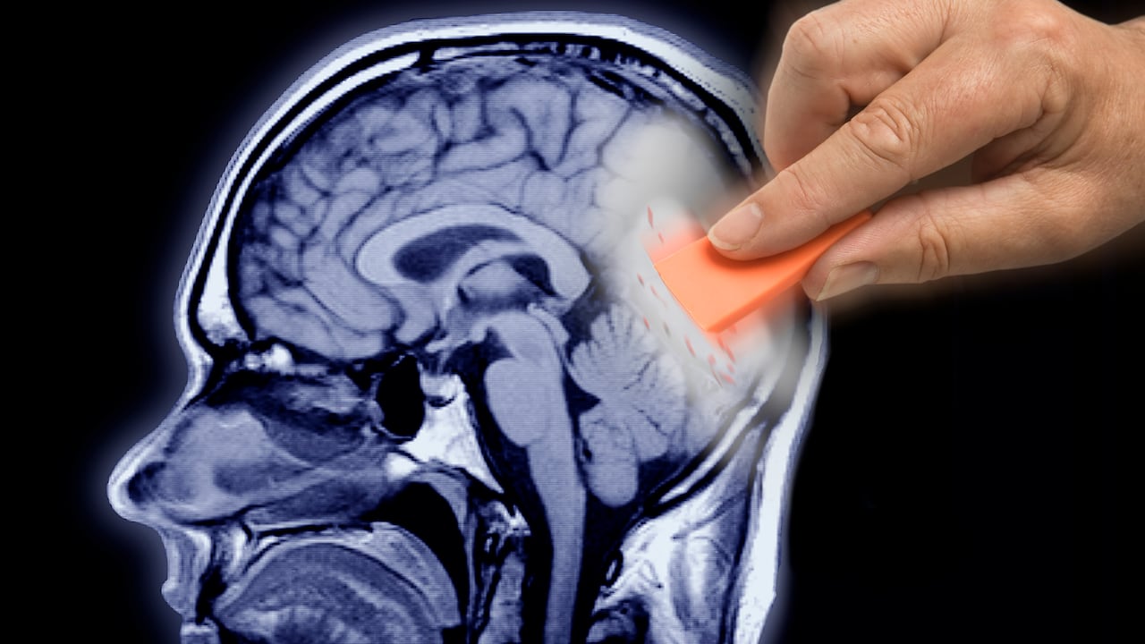 La pérdida de la memoria es un "olvido inusual".