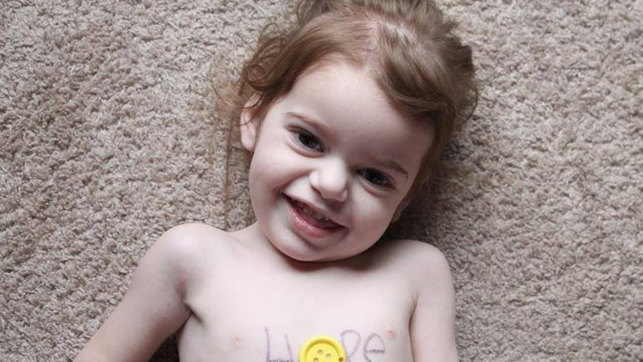 Una de cada una de cada 5.000 personas padecen una enfermedad rara en Colombia