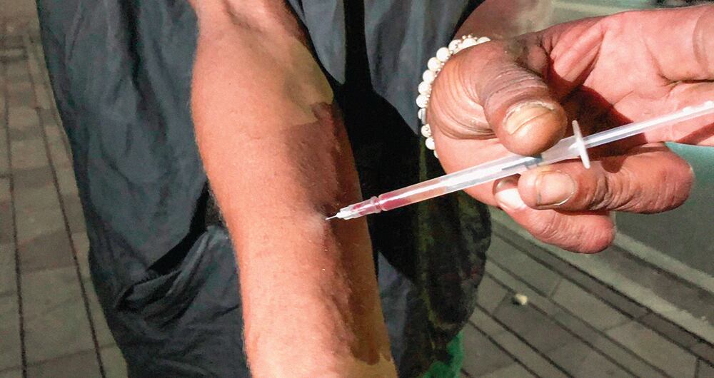 Las marcas están en el cuello, los brazos, las piernas, la espalda y la lengua. 