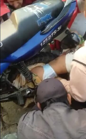 El niño sufrió fracturas en sus piernas.