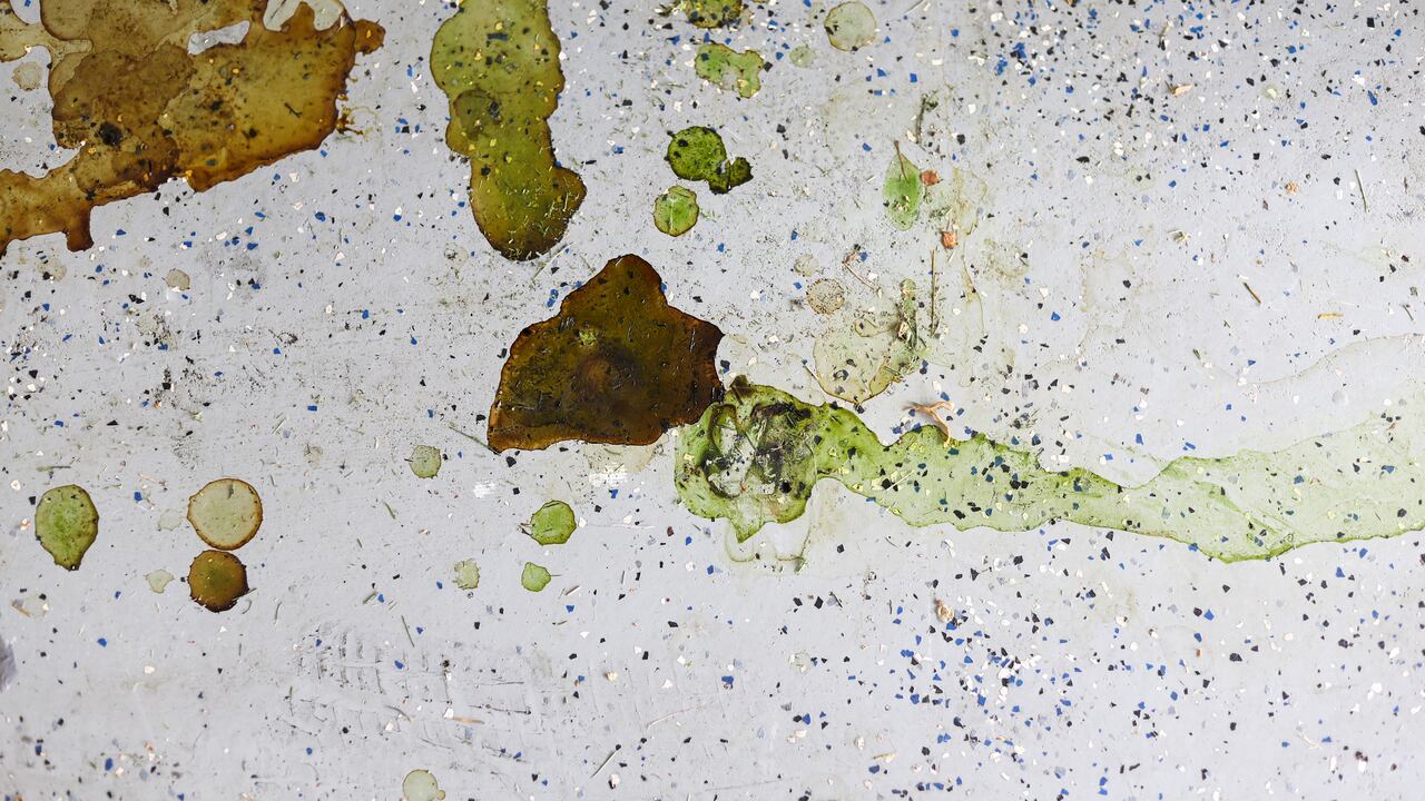 La falta de limpieza puede contribuir a la acumulación de grasa.