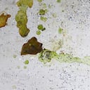 La falta de limpieza puede contribuir a la acumulación de grasa.