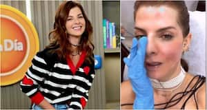 Carolina Cruz mostró doloroso procedimiento estético al que se somete para realzar su belleza