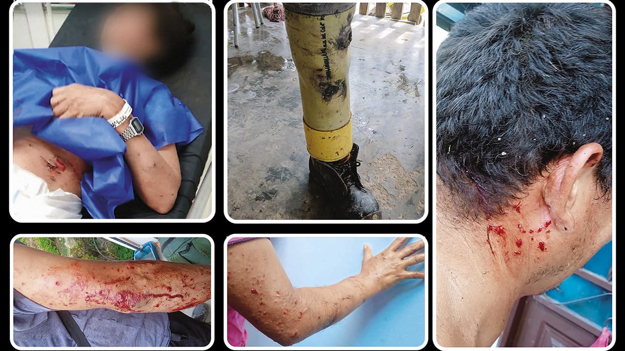 Las víctimas de minas antipersona y drones en el Catatumbo crecen, y Colombia no parece mirarlas. Un hombre pisó una mina y se construyó una prótesis con PVC porque se cansó de pedirle al Estado.