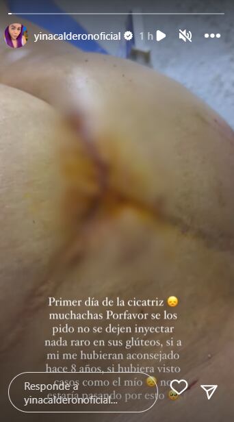 Foto: Instagram @yinacalderonoficial.