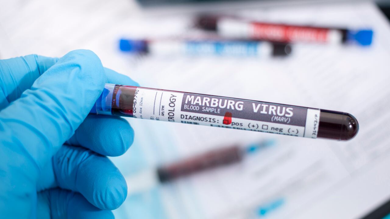 Muestras de sangre ficticias con virus de Marburgo, estetoscopio, máscara y jeringa y otros instrumentos