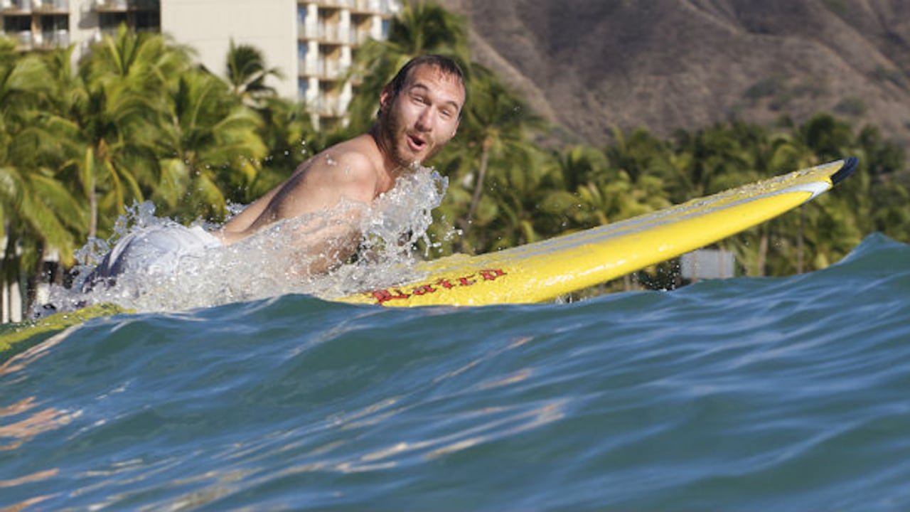 Nick demostró a los médicos que sí podía caminar y que incluso podía surfear.