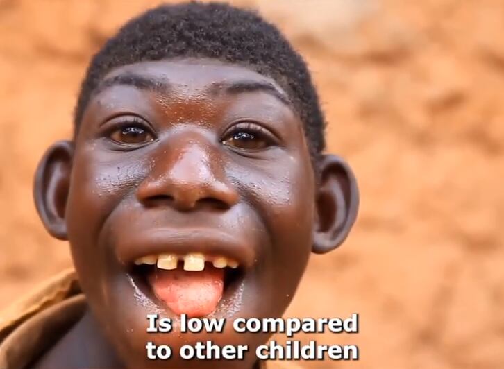 Según cuenta su madre, el joven prefiere alimentarse con plantas y frutas que consigue en los árboles.