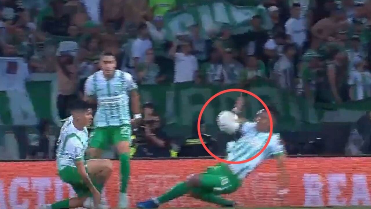 La mano de Tesillo en el Nacional vs. América.