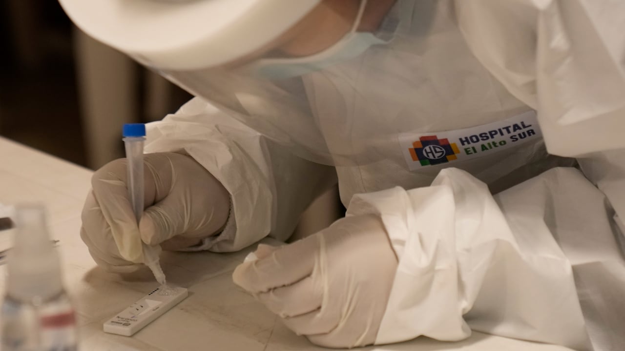 ¿Por qué el coronavirus causa la pérdida del olfato?