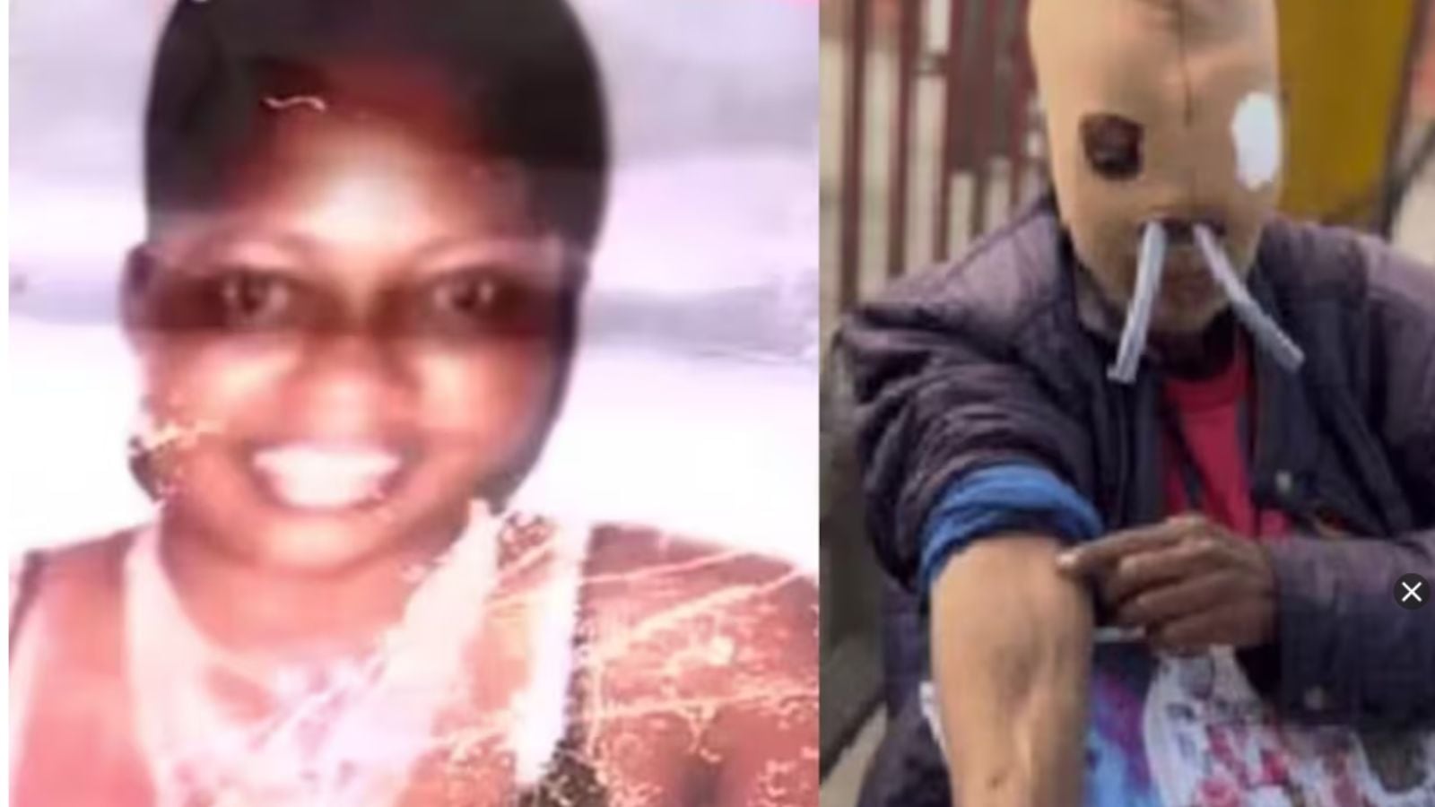 María Consuelo Córdoba, antes y después del ataque con ácido que marcó su vida y la llevó a enfrentar años de tratamientos y cirugías reconstructivas.
