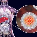 Foto de referencia sobre hepatitis