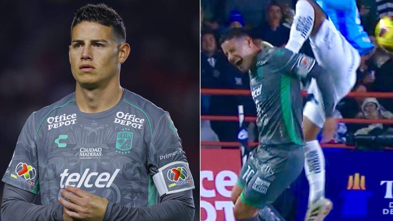 James Rodríguez se retorció de dolor tras la jugada