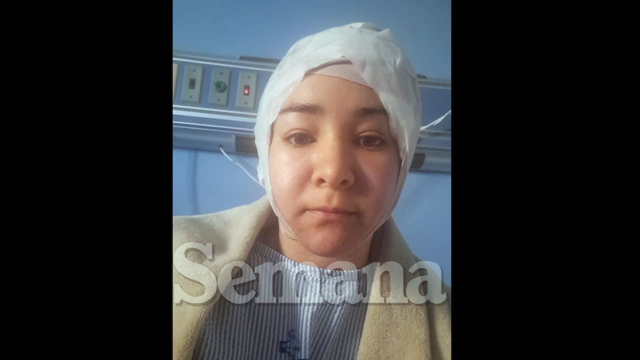 Youlin Franco sobreviviente accidente en República Dominicana