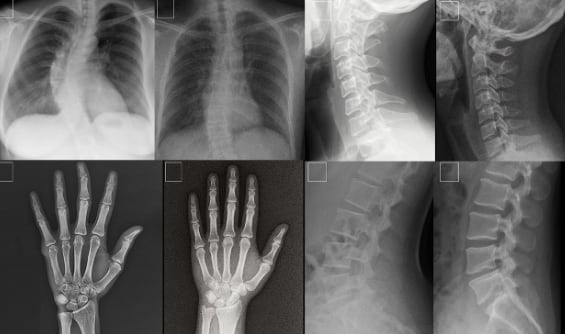 La IA logró imitar radiografías reales y engañar a médicos en varios países.