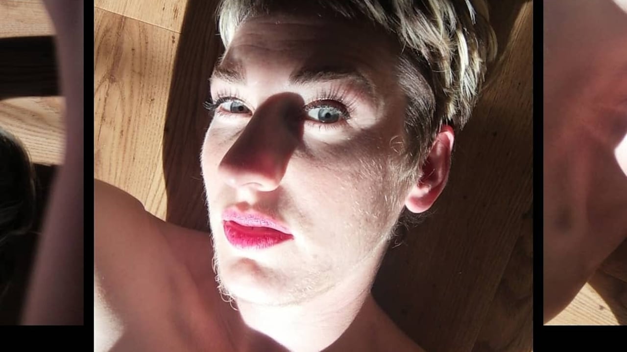 Bethany Burgoyne, la mujer que rompió con un estereotipo de belleza