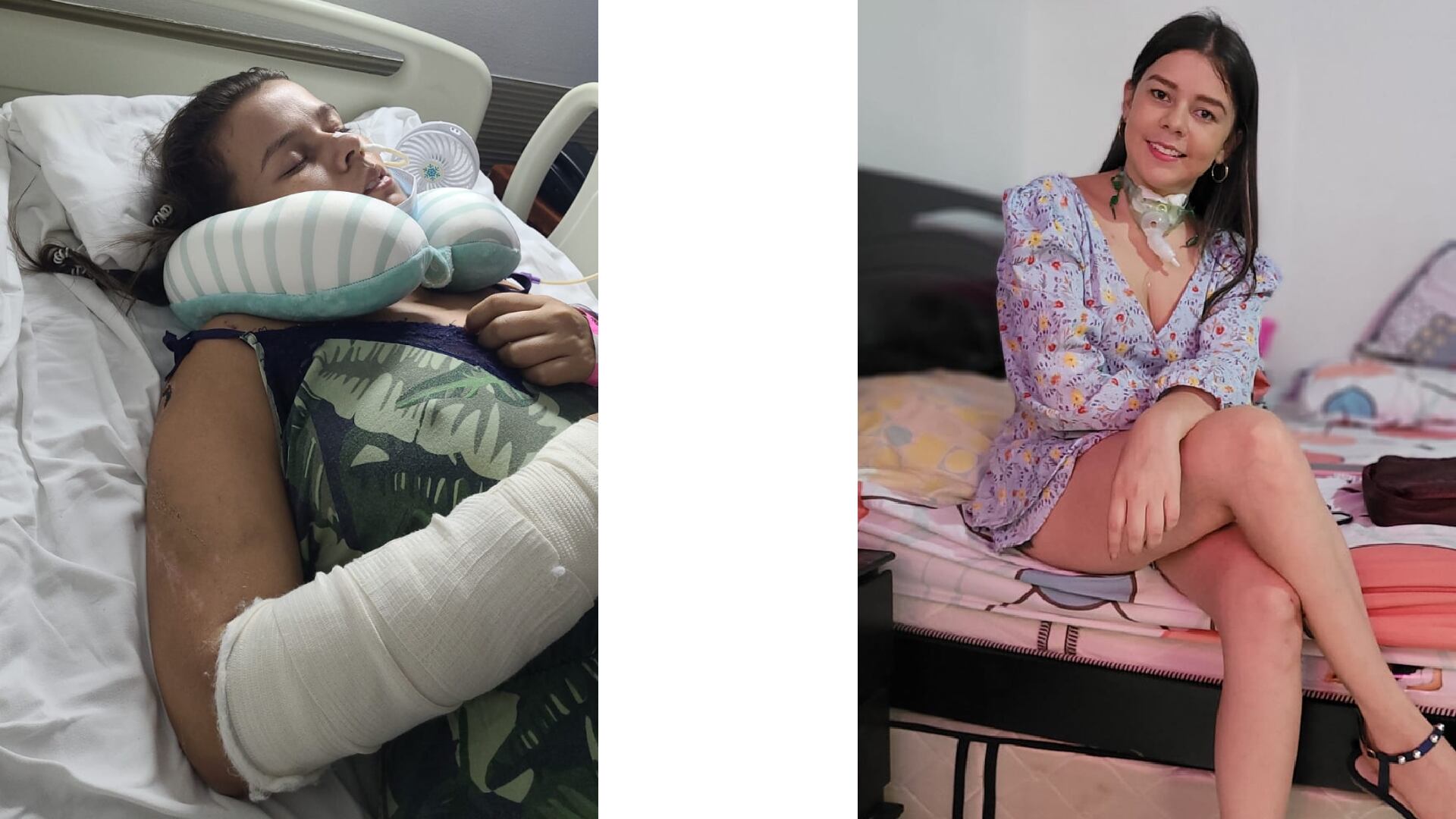 Geraldine Barajas mujer de bucaramanga que sobrevivió a accidente de tránsito